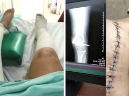 El calvario de Alejandra: accidente laboral, despido injustificado, abuso sexual y abandono institucional
